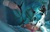 Laparoscopic surgery to remove the gallbladder with stones
